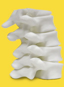 3D printed medical model